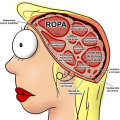 Miniatura de Cerebro De La Mujer